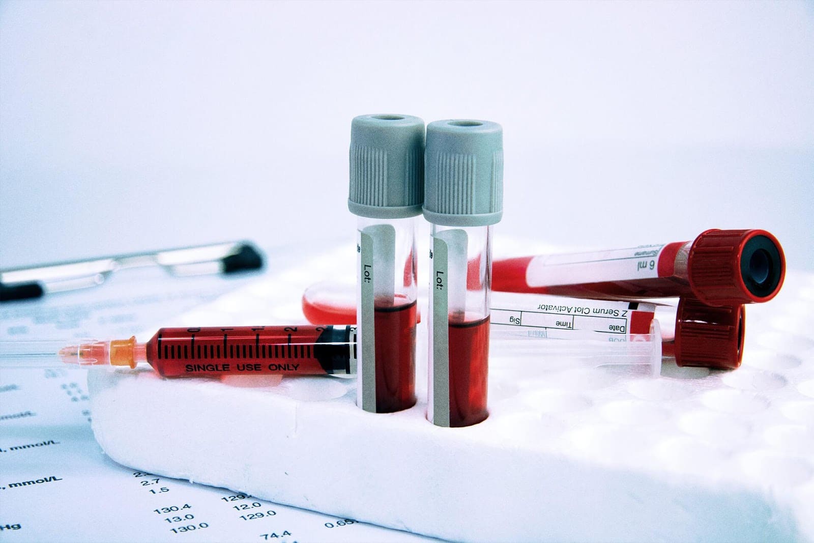 Анализ крови картинки. Анализ крови. Клиническое исследование крови. Исследования крови: клиническое, биохимическое.. Анализы пробирки.