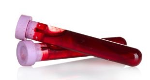 Nature Immunology: длительный COVID оставляет явные следы в крови