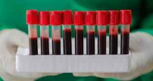 Ученые нашли способ превращения любой группы крови в первую с помощью ферментов