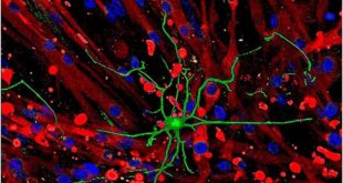 Нервы побуждают мышцы выделять факторы, способствующие здоровью мозга