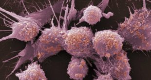 Ученые Гонконга создали препарат, заставляющий раковые клетки самоуничтожаться