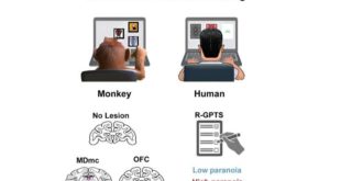 Новое исследование дает представление об областях мозга, участвующих в развитии паранойи