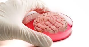 Выращенный учеными мини-мозг подтвердил теорию об аутизме